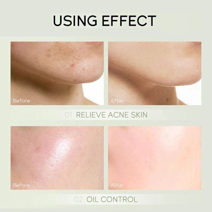 61Iofp1J-L._AC_SL1500.jpg 61Iofp1J-L._AC_SL1500.jpg