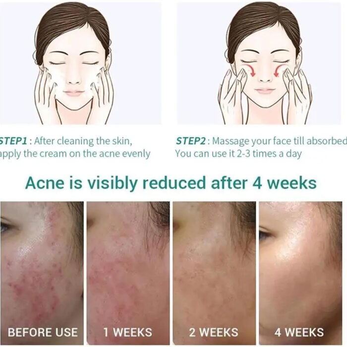 71n4PkFGlHL._AC_SL1500.jpg 71n4PkFGlHL._AC_SL1500.jpg